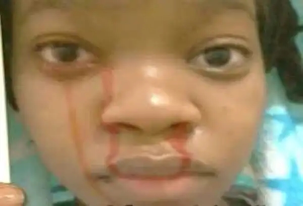 How TB Joshua delivered girl who cried blood [ PHOTOS/VIDEO]